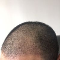 發(fā)際線用戶圖片