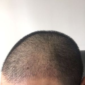 发际线分享社区