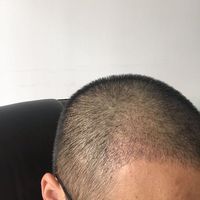 發(fā)際線用戶圖片