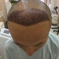 發(fā)際線用戶圖片