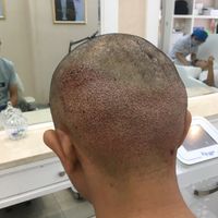 發(fā)際線用戶圖片