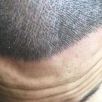 發(fā)際線用戶圖片