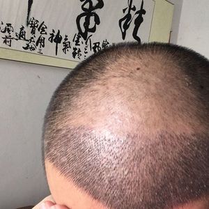 发际线分享社区