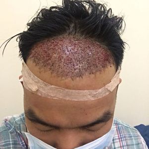 发际线分享社区