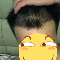 發(fā)際線用戶圖片
