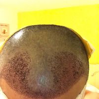 發(fā)際線用戶圖片
