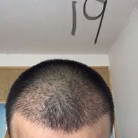 發(fā)際線用戶圖片