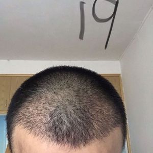 发际线分享社区
