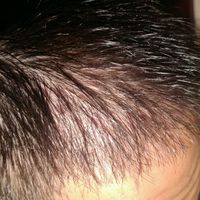 發(fā)際線用戶圖片