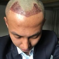 發(fā)際線用戶圖片