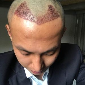 发际线分享社区