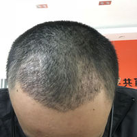 發(fā)際線用戶圖片