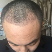 發(fā)際線用戶圖片