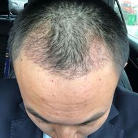 發(fā)際線用戶圖片