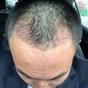 发际线分享社区