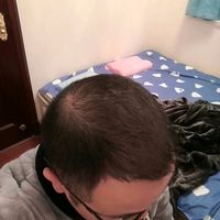 發(fā)際線用戶圖片