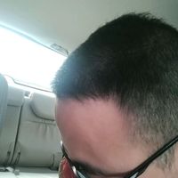 發(fā)際線用戶圖片