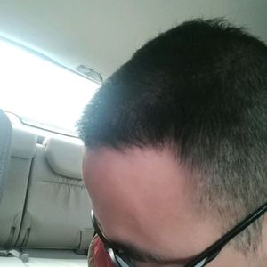 发际线分享社区