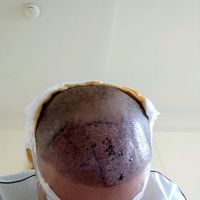 發(fā)際線用戶圖片