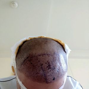 发际线分享社区