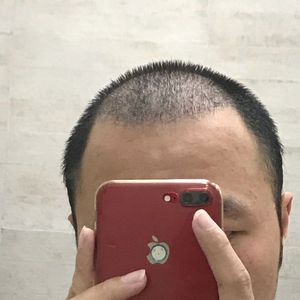 发际线分享社区