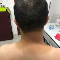 發(fā)際線用戶圖片