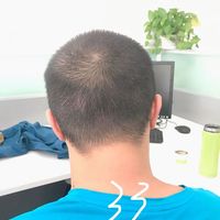 發(fā)際線用戶圖片