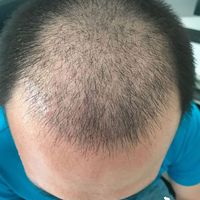 發(fā)際線用戶圖片