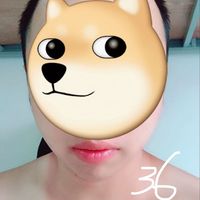 發(fā)際線用戶圖片