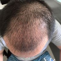 發(fā)際線用戶圖片