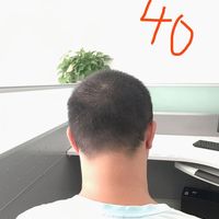 發(fā)際線用戶圖片