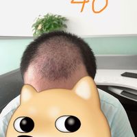 發(fā)際線用戶圖片