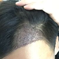 發(fā)際線用戶圖片