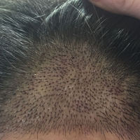 發(fā)際線用戶圖片