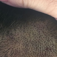 發(fā)際線用戶圖片