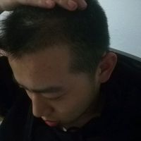 發(fā)際線用戶圖片