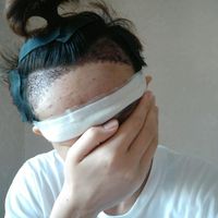 發(fā)際線用戶圖片