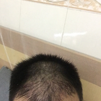 發(fā)際線用戶圖片