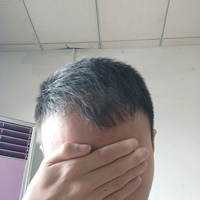 發(fā)際線用戶圖片