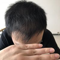 發(fā)際線用戶圖片
