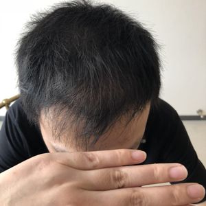发际线分享社区