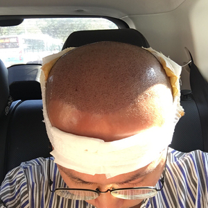 发际线分享社区