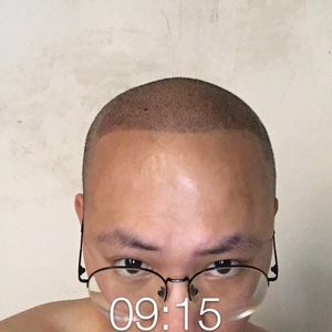 发际线分享社区