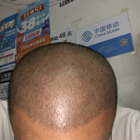 發(fā)際線用戶圖片