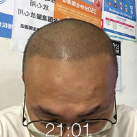 發(fā)際線用戶圖片