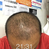 發(fā)際線(xiàn)用戶(hù)圖片