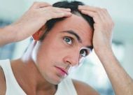 ****脱发是什么 常见临床的六大特征