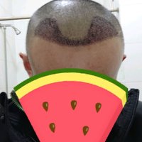 發(fā)際線(xiàn)用戶(hù)圖片