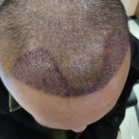 發(fā)際線(xiàn)用戶(hù)圖片