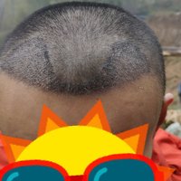 發(fā)際線(xiàn)用戶(hù)圖片